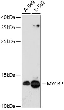 Western blot analysis of extracts of various cell lines using MYCBP Polyclonal Antibody at dilution of 1:3000.