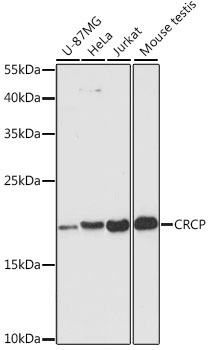 Western blot analysis of extracts of various cell lines using CRCP Polyclonal Antibody at dilution of 1:3000.