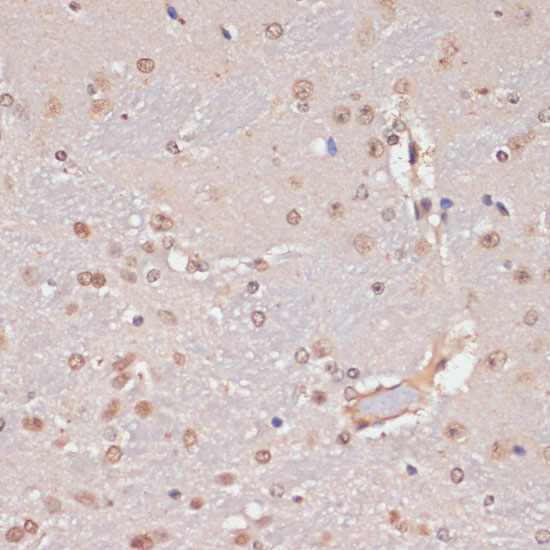 Immunohistochemistry of paraffin-embedded Mouse brain using PIDD Polyclonal Antibody at dilution of  1:100 (40x lens).