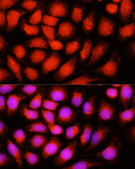 Immunofluorescence analysis of Hela cells using DNAJB14 Polyclonal Antibody at dilution of  1:100 (40x lens). Blue: DAPI for nuclear staining.