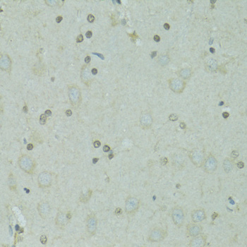 Immunohistochemistry of paraffin-embedded Rat brain using GTF2H2C Polyclonal Antibody at dilution of  1:100 (40x lens).