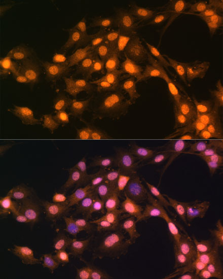 Immunofluorescence analysis of C6 cells using Snail Polyclonal Antibody at dilution of  1:100. Blue: DAPI for nuclear staining.