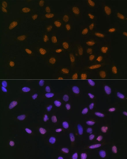 Immunofluorescence analysis of U-2 OS cells using Snail Polyclonal Antibody at dilution of  1:100. Blue: DAPI for nuclear staining.