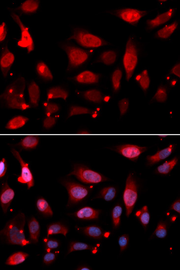 Immunofluorescence analysis of U2OS cells using RACGAP1 Polyclonal Antibody