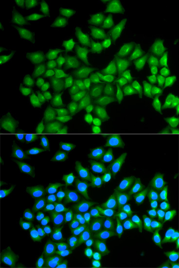 Immunofluorescence analysis of MCF-7 cells using DAO Polyclonal Antibody