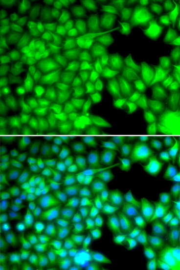 Immunofluorescence analysis of U2OS cells using FABP3 Polyclonal Antibody