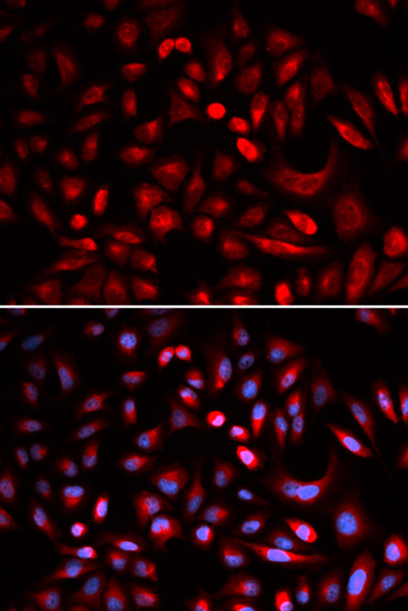 Immunofluorescence analysis of U2OS cells using PRKACB Polyclonal Antibody