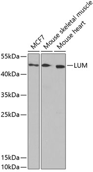 Western blot analysis of extracts of various cell lines using LUM Polyclonal Antibody at dilution of 1:1000.