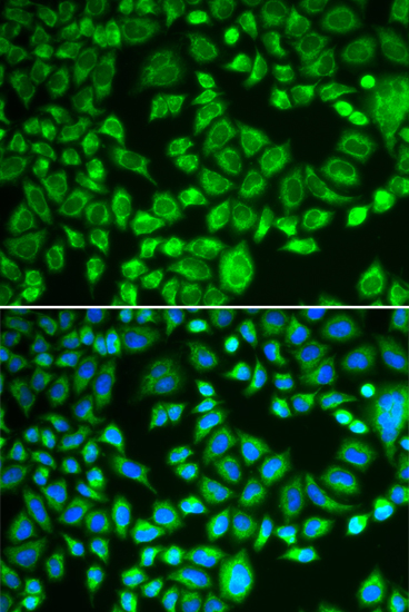 Immunofluorescence analysis of MCF-7 cells using PSMD7 Polyclonal Antibody