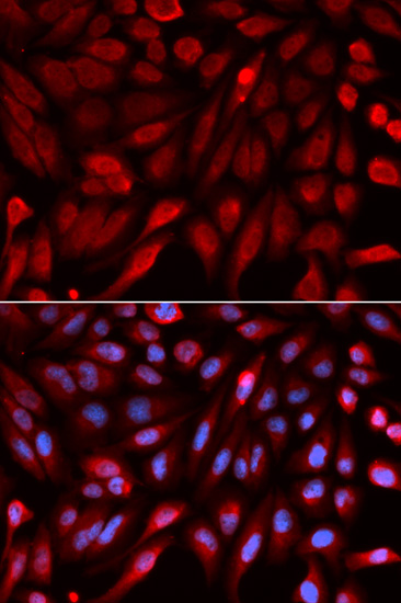 Immunofluorescence analysis of U2OS cells using SDCBP Polyclonal Antibody