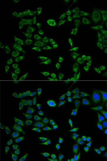 Immunofluorescence analysis of HeLa cells using VAPB Polyclonal Antibody