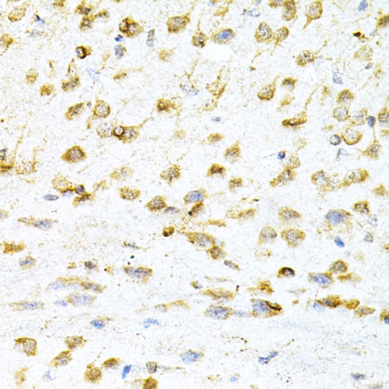 Immunohistochemistry of paraffin-embedded Mouse brain using VAPB Polyclonal Antibody at dilution of  1:200 (40x lens).