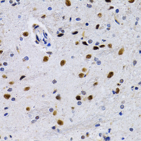 Immunohistochemistry of paraffin-embedded Rat brain using ID3 Polyclonal Antibody at dilution of  1:200 (40x lens).