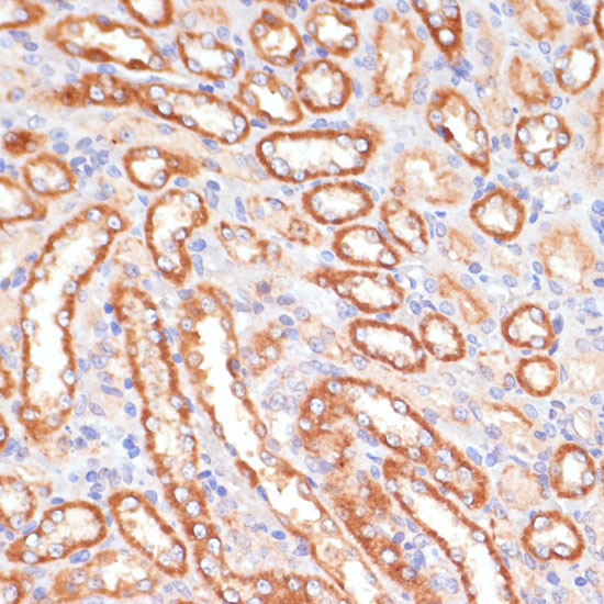 Immunohistochemistry of paraffin-embedded Rat kidney using CYB5A Polyclonal Antibody at dilution of  1:100 (40x lens).