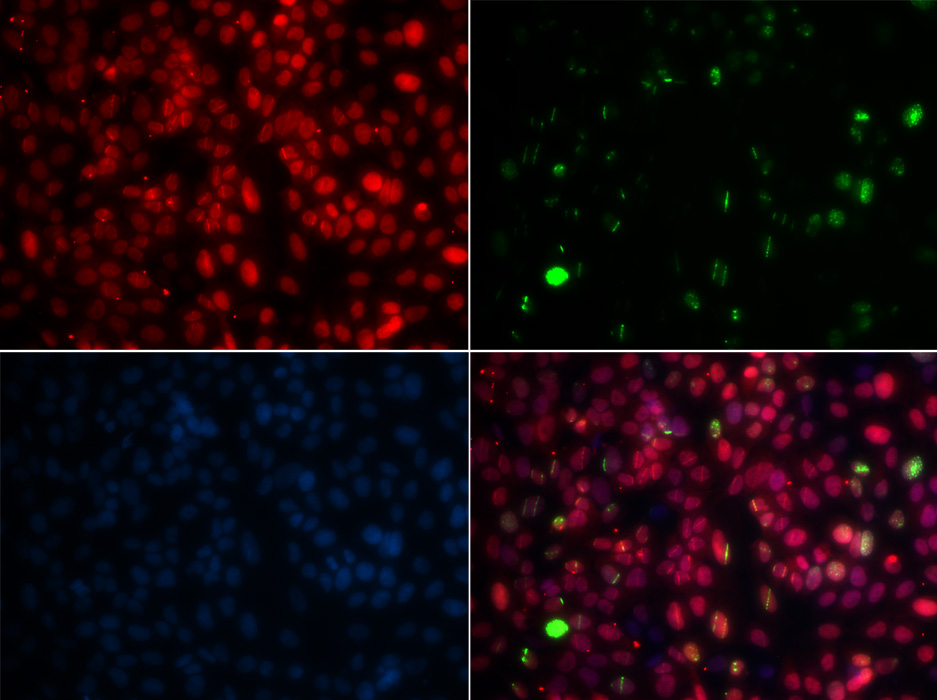 Immunofluorescence analysis of GFP-RNF168 transgenic U2OS cells using MPG Polyclonal Antibody