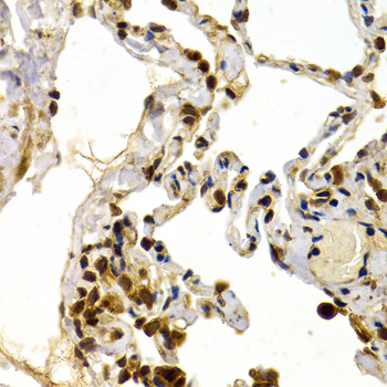 Immunohistochemistry of paraffin-embedded Human lung using TFDP1 Polyclonal Antibody at dilution of  1:200 (40x lens).