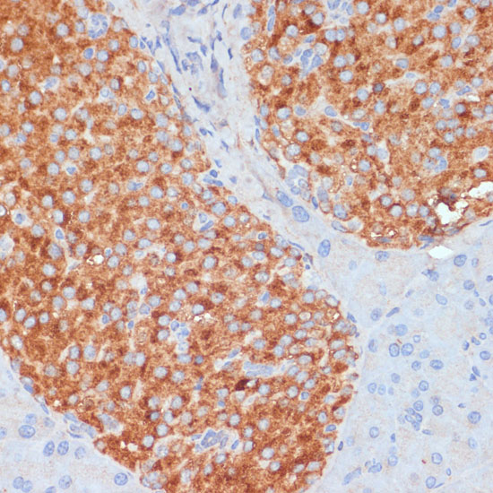 Immunohistochemistry of paraffin-embedded Mouse pancreas using RIP3 Polyclonal Antibody at dilution of  1:100 (40x lens).