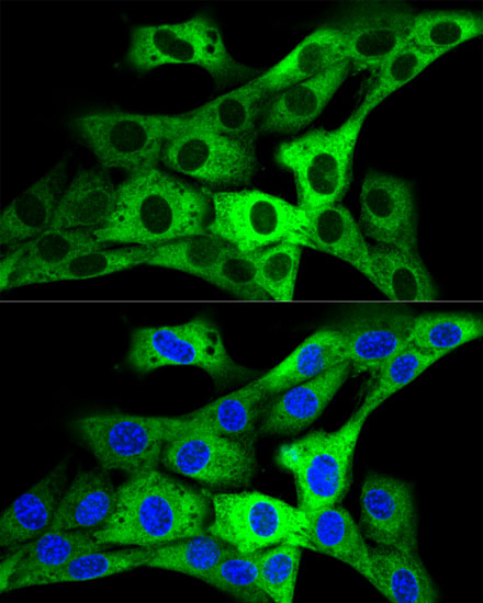 Confocal immunofluorescence analysis of NIH-3T3 cells using GARS Polyclonal Antibody at dilution of  1:200. Blue: DAPI for nuclear staining.