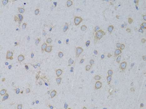 Immunohistochemistry of paraffin-embedded Rat brain using GARS Polyclonal Antibody at dilution of  1:100 (40x lens).