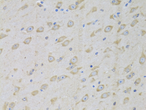 Immunohistochemistry of paraffin-embedded Mouse brain using GARS Polyclonal Antibody at dilution of  1:100 (40x lens).