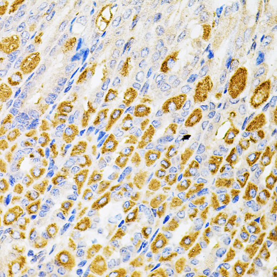 Immunohistochemistry of paraffin-embedded Mouse stomach using RPS6KA3 Polyclonal Antibody at dilution of  1:100 (40x lens).