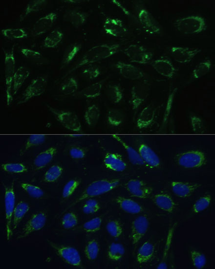 Immunofluorescence analysis of U-2 OS cells using HSD17B10 Polyclonal Antibody at dilution of  1:100 (40x lens). Blue: DAPI for nuclear staining.