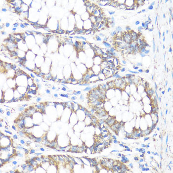Immunohistochemistry of paraffin-embedded Human colon using HSD17B10 Polyclonal Antibody at dilution of  1:100 (40x lens).