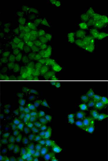 Immunofluorescence analysis of HeLa cells using PSMB10 Polyclonal Antibody