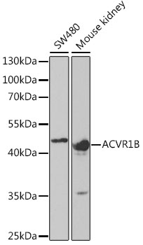 Western blot analysis of extracts of various cell lines using ACVR1B Polyclonal Antibody at dilution of 1:1000.