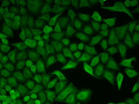 Immunofluorescence analysis of HeLa cells using CDC34 Polyclonal Antibody