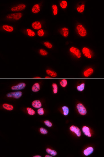 Immunofluorescence analysis of U2OS cells using PRPF3 Polyclonal Antibody