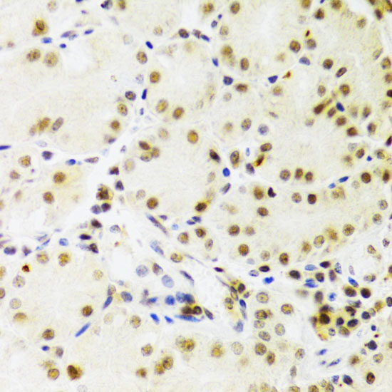 Immunohistochemistry of paraffin-embedded Human stomach using PRPF3 Polyclonal Antibody at dilution of  1:100 (40x lens).