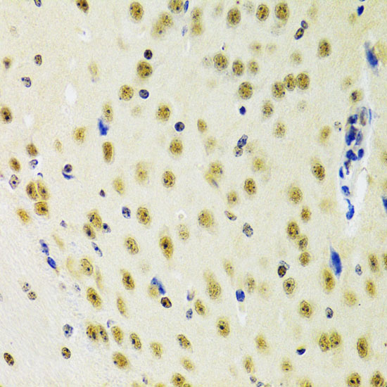 Immunohistochemistry of paraffin-embedded Mouse brain using PRPF3 Polyclonal Antibody at dilution of  1:100 (40x lens).