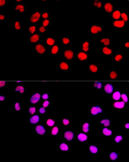 Immunofluorescence analysis of 293T cells using DNMT1 Polyclonal Antibody at dilution of  1:100 (40x lens). Blue: DAPI for nuclear staining.