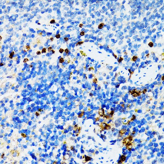 Immunohistochemistry of paraffin-embedded Mouse spleen using STAT3 Polyclonal Antibody at dilution of  1:100 (40x lens).