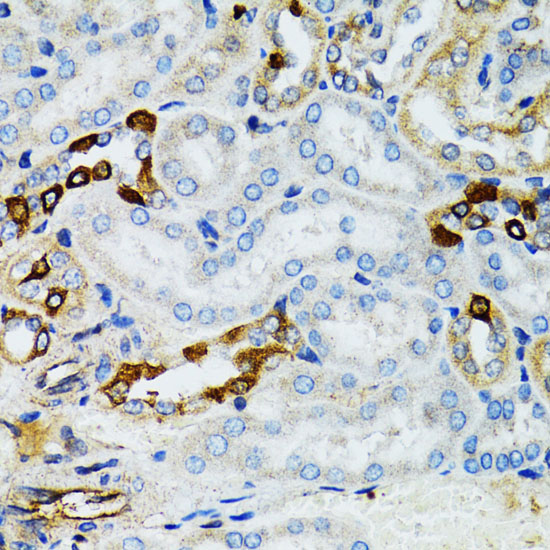 Immunohistochemistry of paraffin-embedded Mouse kidney using STAT3 Polyclonal Antibody at dilution of  1:100 (40x lens).