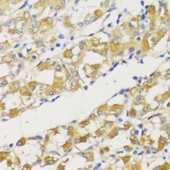 Immunohistochemistry of paraffin-embedded Human stomach using Snail Polyclonal Antibody at dilution of  1:100 (40x lens).