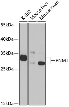 Western blot analysis of extracts of various cell lines using PNMT Polyclonal Antibody at dilution of 1:1000.