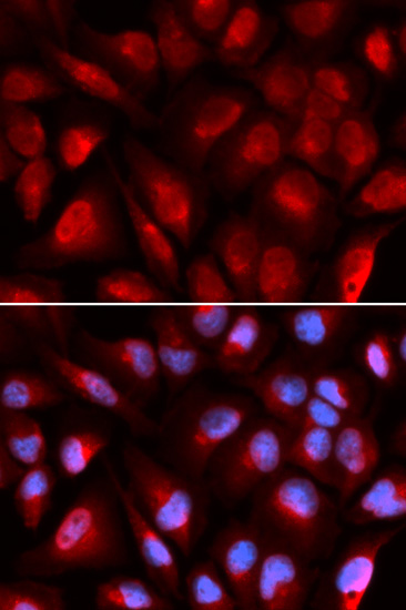 Immunofluorescence analysis of U2OS cells using MCM5 Polyclonal Antibody