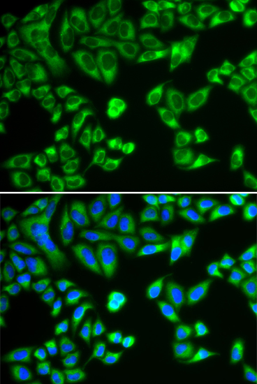 Immunofluorescence analysis of HeLa cells using SH2B1 Polyclonal Antibody