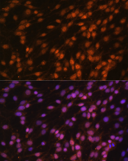 Immunofluorescence analysis of C6 cells using FUBP1 Polyclonal Antibody at dilution of  1:100. Blue: DAPI for nuclear staining.