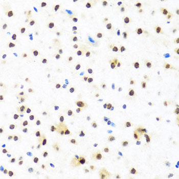 Immunohistochemistry of paraffin-embedded Mouse brain using FUBP1 Polyclonal Antibody at dilution of  1:100 (40x lens).