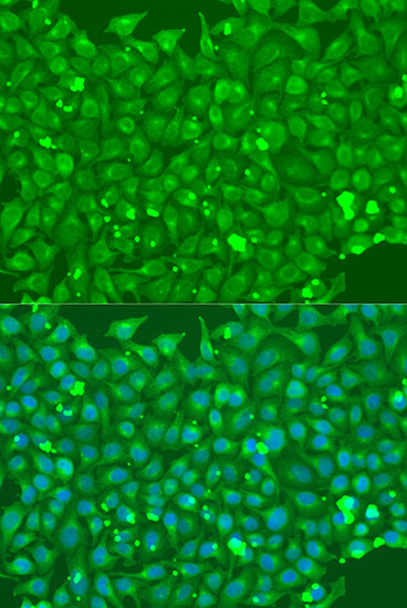 Immunofluorescence analysis of U2OS cells using FLT4 Polyclonal Antibody at dilution of  1:100. Blue: DAPI for nuclear staining.