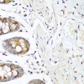 Immunohistochemistry of paraffin-embedded Human colon using FLT4 Polyclonal Antibody at dilution of  1:200 (40x lens).