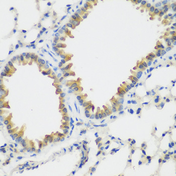 Immunohistochemistry of paraffin-embedded Mouse lung using FLT4 Polyclonal Antibody at dilution of  1:200 (40x lens).