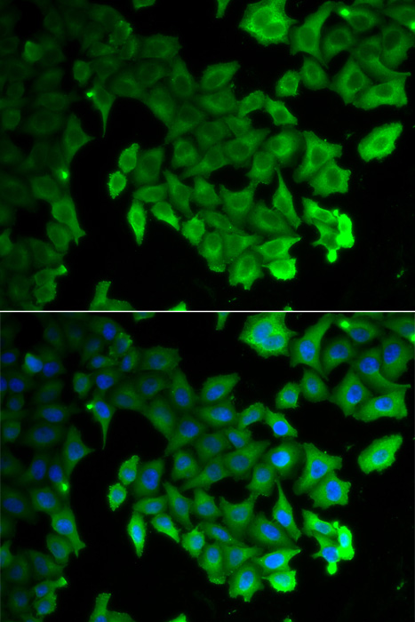 Immunofluorescence analysis of HeLa cells using LC3A/LC3B Polyclonal Antibody