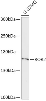 Western blot analysis of extracts of U-87MG cells using ROR2 Polyclonal Antibody at dilution of 1:1000.