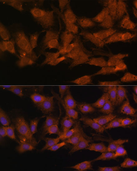 Immunofluorescence analysis of C6 cells using DDX3X Polyclonal Antibody at dilution of  1:100. Blue: DAPI for nuclear staining.