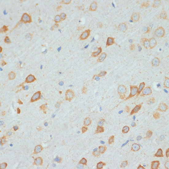 Immunohistochemistry of paraffin-embedded Rat brain using DDX3X Polyclonal Antibody at dilution of  1:100 (40x lens).