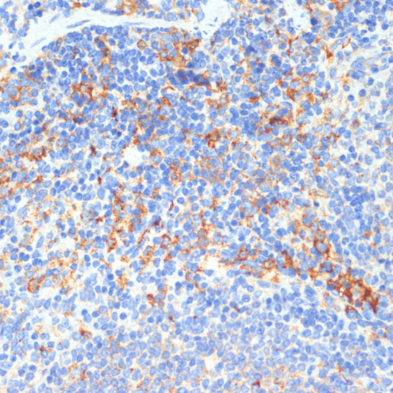 Immunohistochemistry of paraffin-embedded Mouse spleen using DDX3X Polyclonal Antibody at dilution of  1:100 (40x lens).